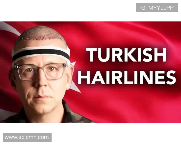 土耳其植发技术助力足球明星重塑自信与风采